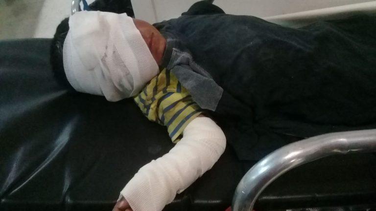 Imagen: Niño resultó con quemaduras en su cuerpo tras derramarse combustible en Chapantongo