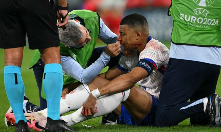 Imagen: Mbappé en duda para el enfrentamiento contra Países Bajos tras fractura nasal