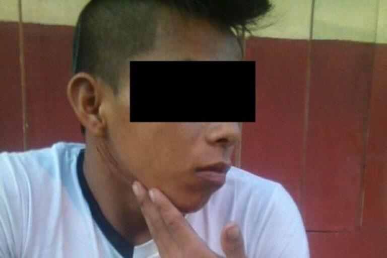 Imagen: En cantina de Huejutla, arañan a joven por manolarga