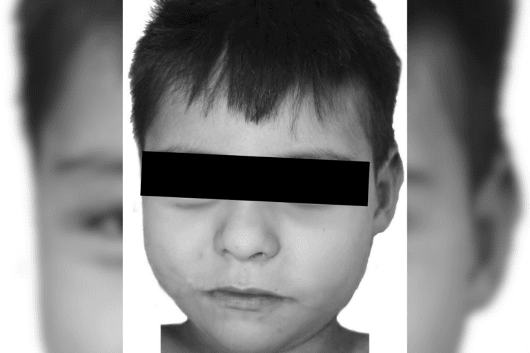 Imagen: Hidalgo: aclaran caso de menor ingresado al SEMEFO; no se trata de un niño desaparecido