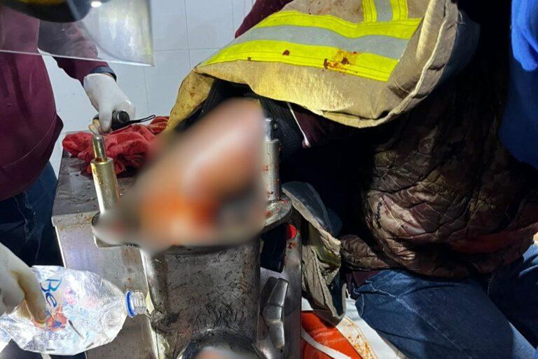 Imagen: Fatal accidente en fábrica de embutidos de Tulancingo
