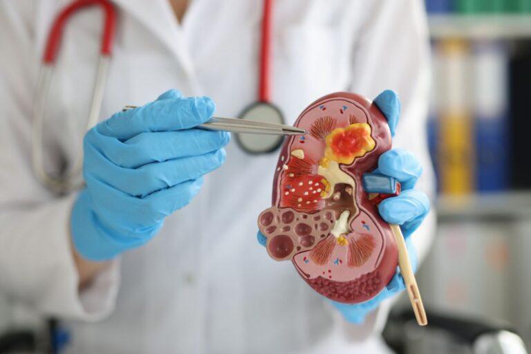 Imagen: Entérate: Harán evaluaciones gratuitas para salud renal en Tepeji del Río