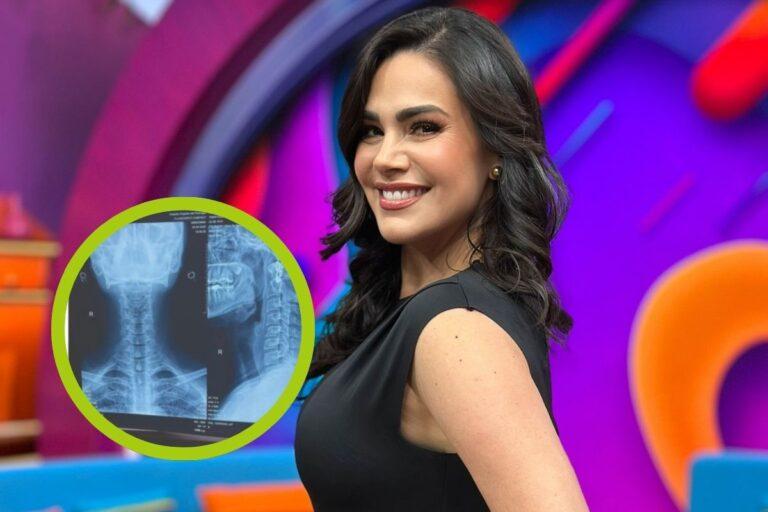 Imagen: Actriz Luz Elena González sufrió un accidente que casi pone su vida en peligro