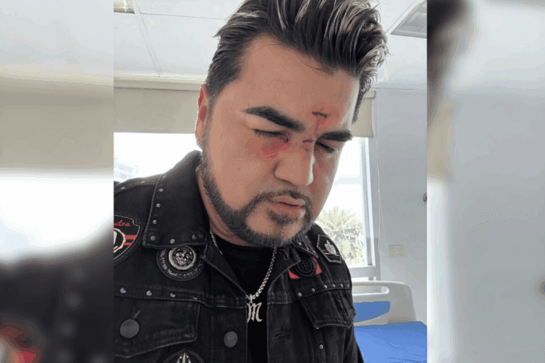 Imagen: El Mimoso preocupa a fans tras difundir foto con heridas