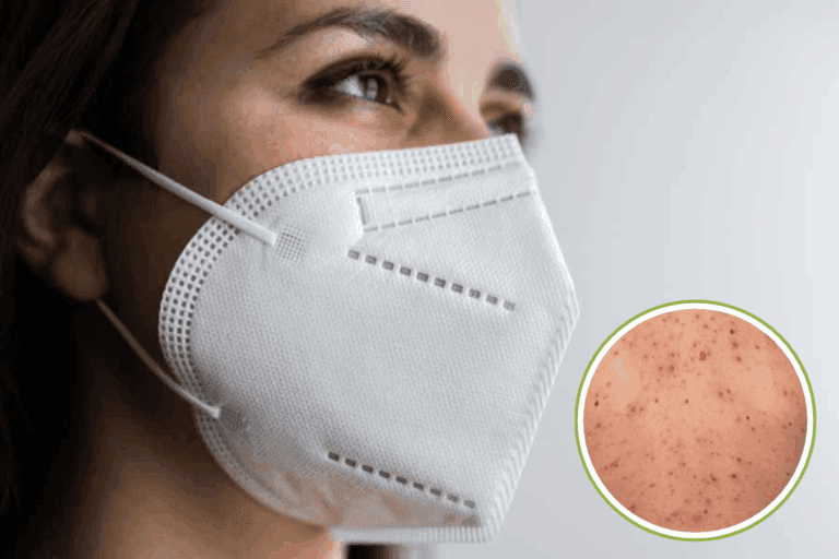 Imagen: ¿Cubrebocas por sarampión? Esto dicen autoridades de Salud en Hidalgo